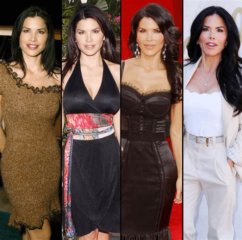 lauren sanchez surgery|Lauren Sanchez Plastic Surgery